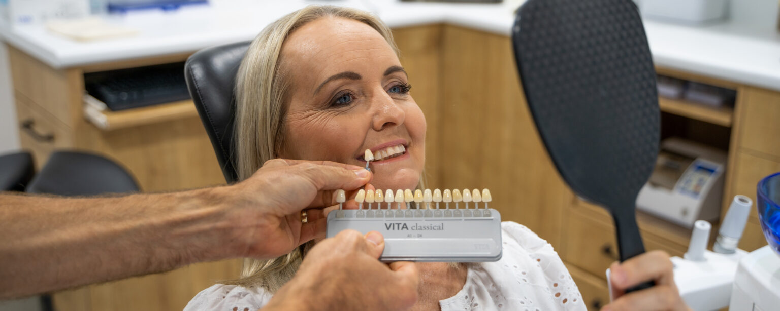 Dental-Veneers-Hervey-Bay-bnr